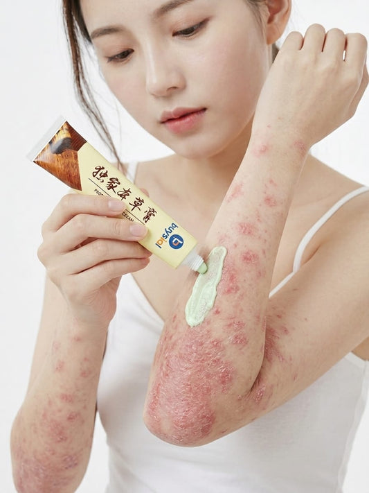 Buysial yellow Psoriasis, Fungal & Eczema Relief Cream