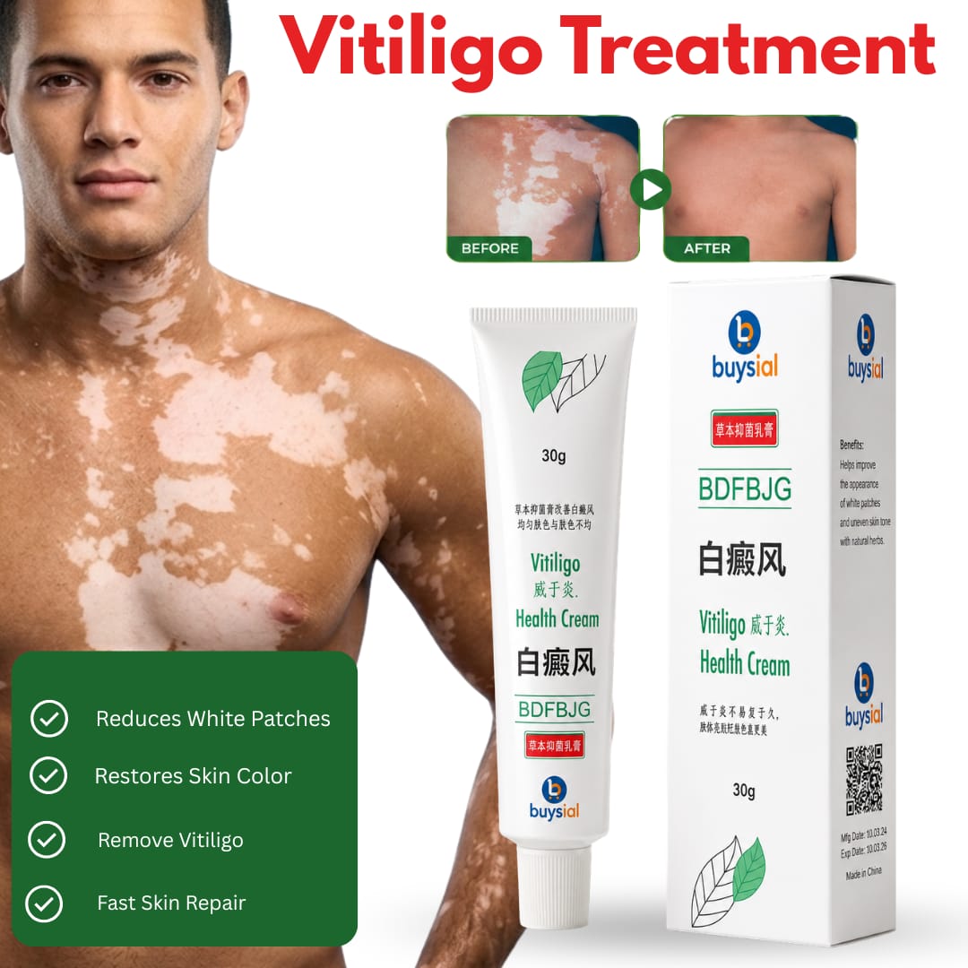 Buysial Vitiligo Healthcare Cream